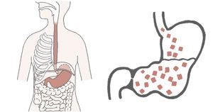 消化だけじゃない！ 胃の機能とピロリ菌を知ることが胃の健康の第一歩