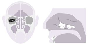 「副鼻腔炎」はなぜ起こる？ 様々な原因とかかってしまった際の治療法を解説