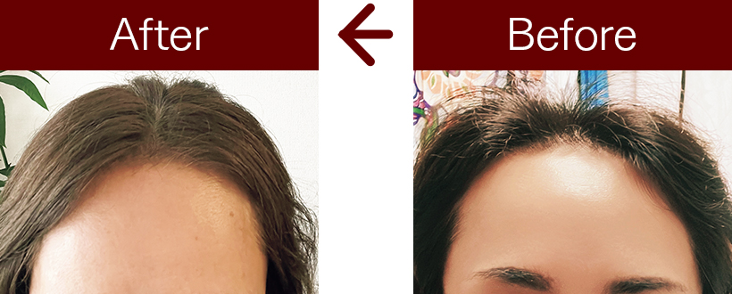 育毛、発毛に。医療だから叶う“結果が期待できる”クリニックでの治療法