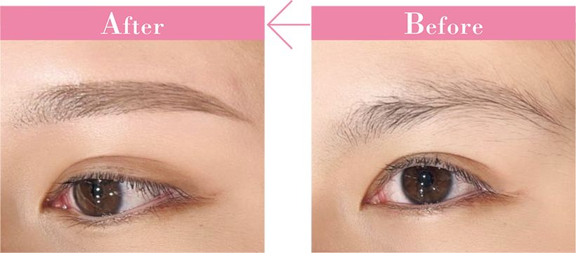 眉まわりや眉間の産毛、まばらな毛がなくなりすっきりした印象。ワックスは古い角質も取り除くので肌のトーンアップ効果も。