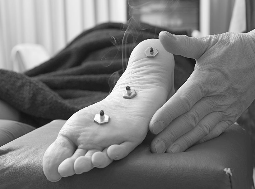 仙骨まわりを中心に下半身の緊張を取ったうえで患部の痛みにアプローチ。温灸だけで軽減できないときは足裏に鍼を打つ。