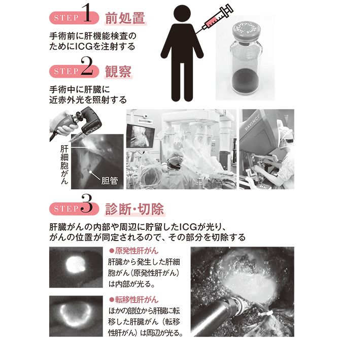 取材および石沢武彰先生からの提供資料をもとに作成