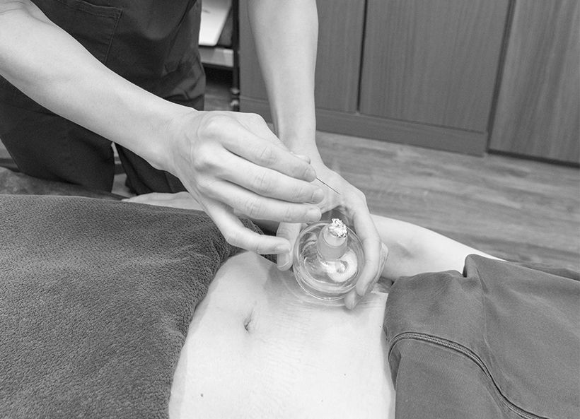 疼痛緩和に高い効果がある火鍼（かしん）を使用する独特の治療を行う。