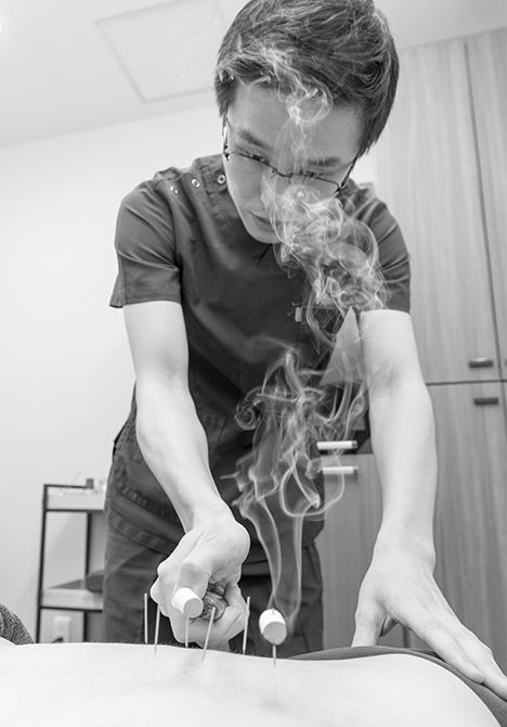 鍼と灸の効果を同時に得られる灸頭鍼（きゅうとうしん）を活用することも多い。