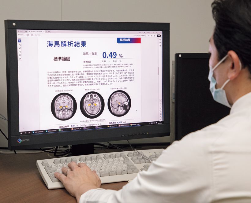 脳の海馬の大きさを測定するAI認知機能検査をオプション検査として新しく導入。