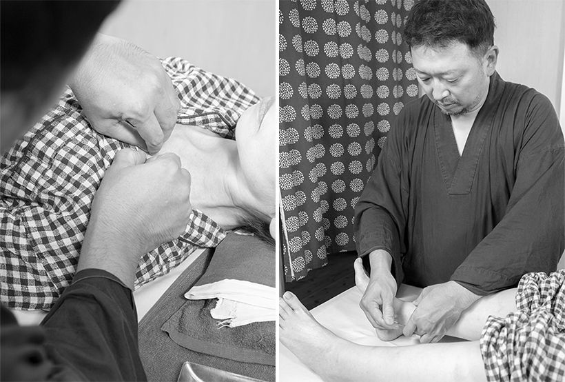 復溜（ふくりゅう）（右）と兪府（ゆふ）（左）の経穴に鍼を留置し、副腎疲労を改善。