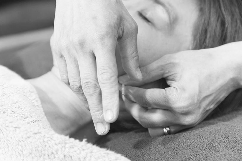 鍼で刺激して咬筋の張りをとる。緊張している筋肉に鍼を刺すと痛みが生じるので、患部を温め、少し緩んだ状態で鍼治療を行う。