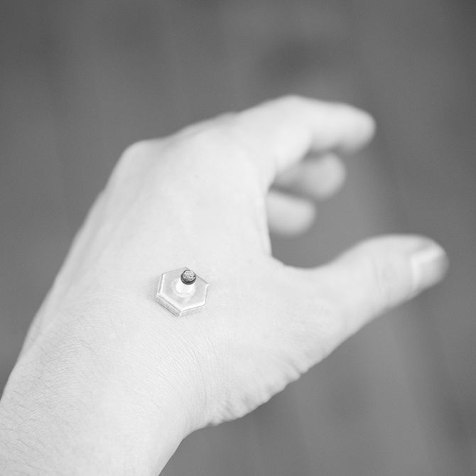 ツボ押しの代わりにソフト灸を据えてもよい。