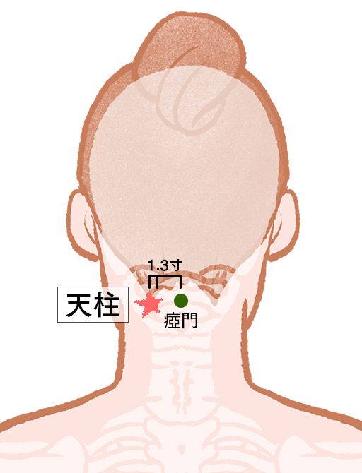天柱（てんちゅう）瘂門（あもん）