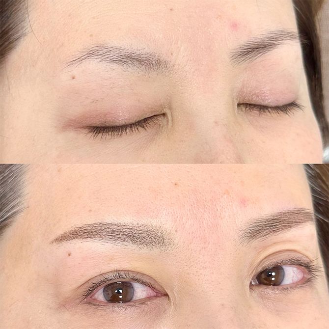 上が施術前、下が施術後。もとから生えそろった眉に見える自然な仕上がりです。