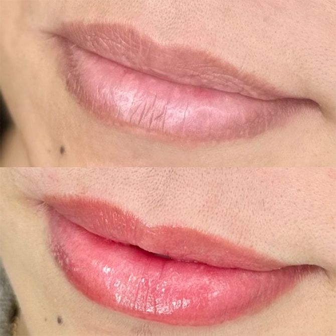 上が施術前、下が施術後。唇全体に血色感が出ることで肌色がパッと明るく。ふっくら立体感のある印象にも。