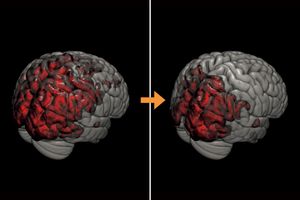 夜のサウナで睡眠の質がアップ。メンタル不調の改善や認知症予防にも効果的