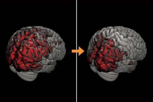 夜のサウナで睡眠の質がアップ。メンタル不調の改善や認知症予防にも効果的