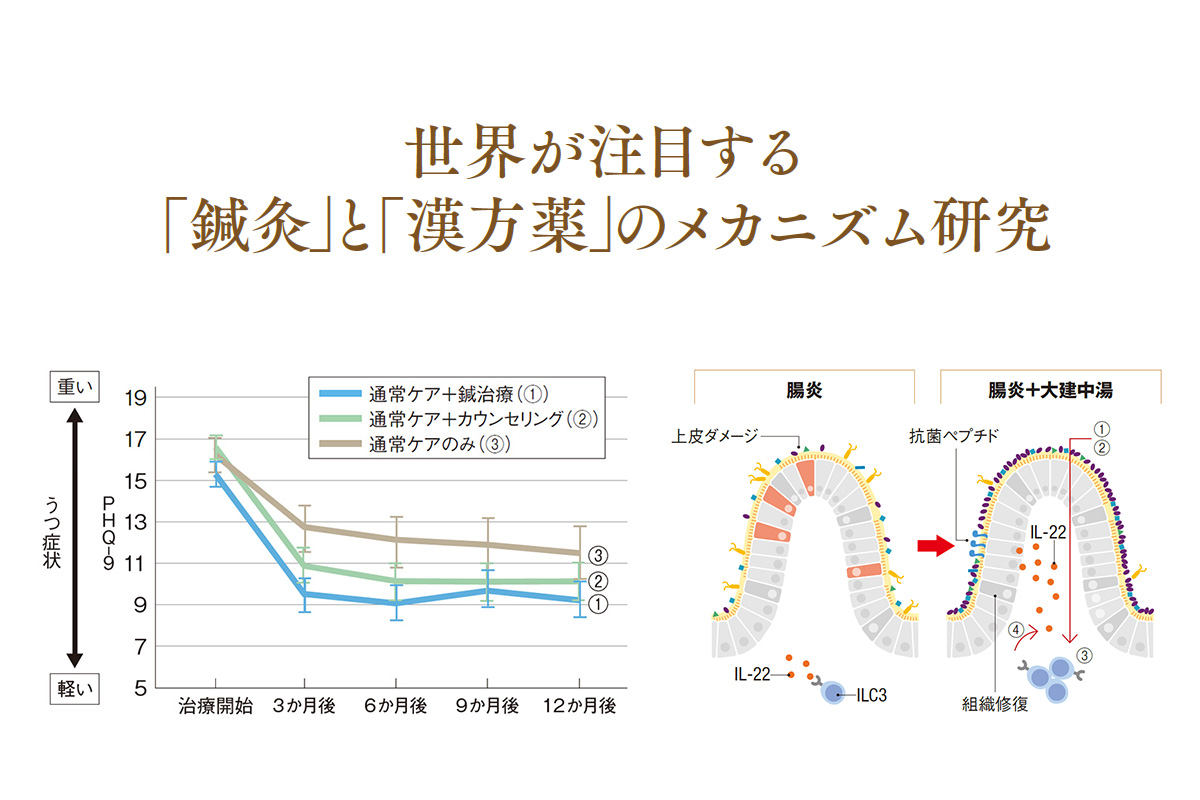 うつ病の改善や免疫力アップに効果的。鍼灸と漢方薬の力を科学で
