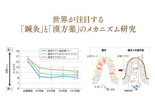 うつ病の改善や免疫力アップに効果的。鍼灸と漢方薬の力を科学で解き明かす