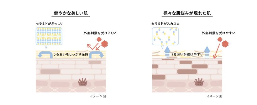 セラミドで満たされた肌は外的刺激を受けにくく、うるおいもきちんと保持できるため、健やかな状態をキープできる。