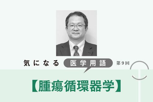 がんやがん治療による合併症を予防する「腫瘍循環器学」。治療の継続を支援する【気になる医学用語】