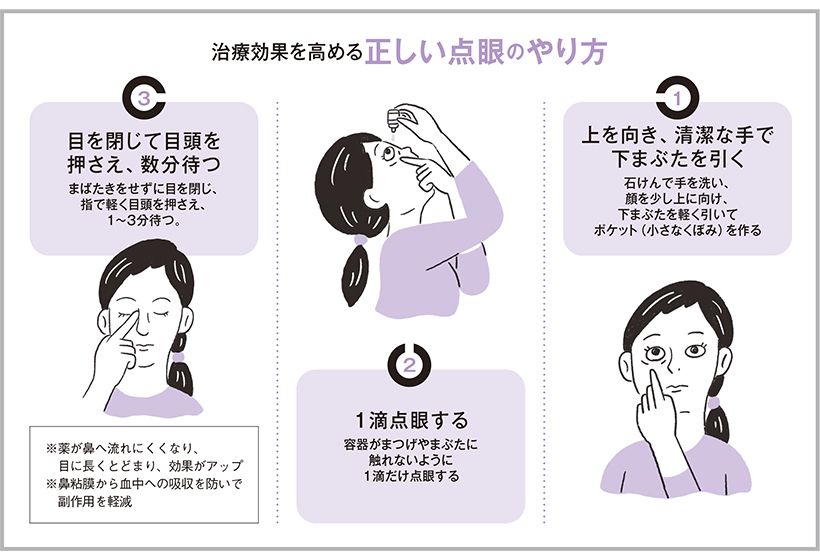 治療効果を高める正しい点眼のやり方