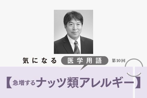 急増する「ナッツ類アレルギー」。成人でも発症し、症状が強く治りにくい【気になる医学用語】