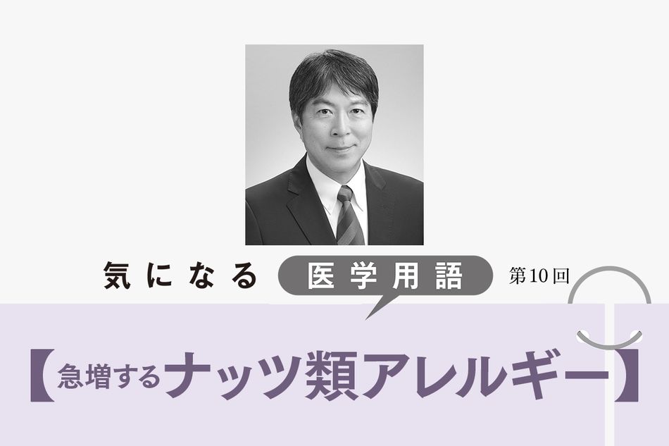 急増する「ナッツ類アレルギー」。成人でも発症し、症状が強く治りにくい【気になる医学用語】
