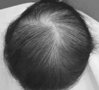 ［全体的に薄い］after
