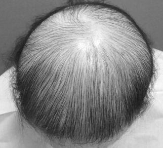 ［全体的に薄い］before